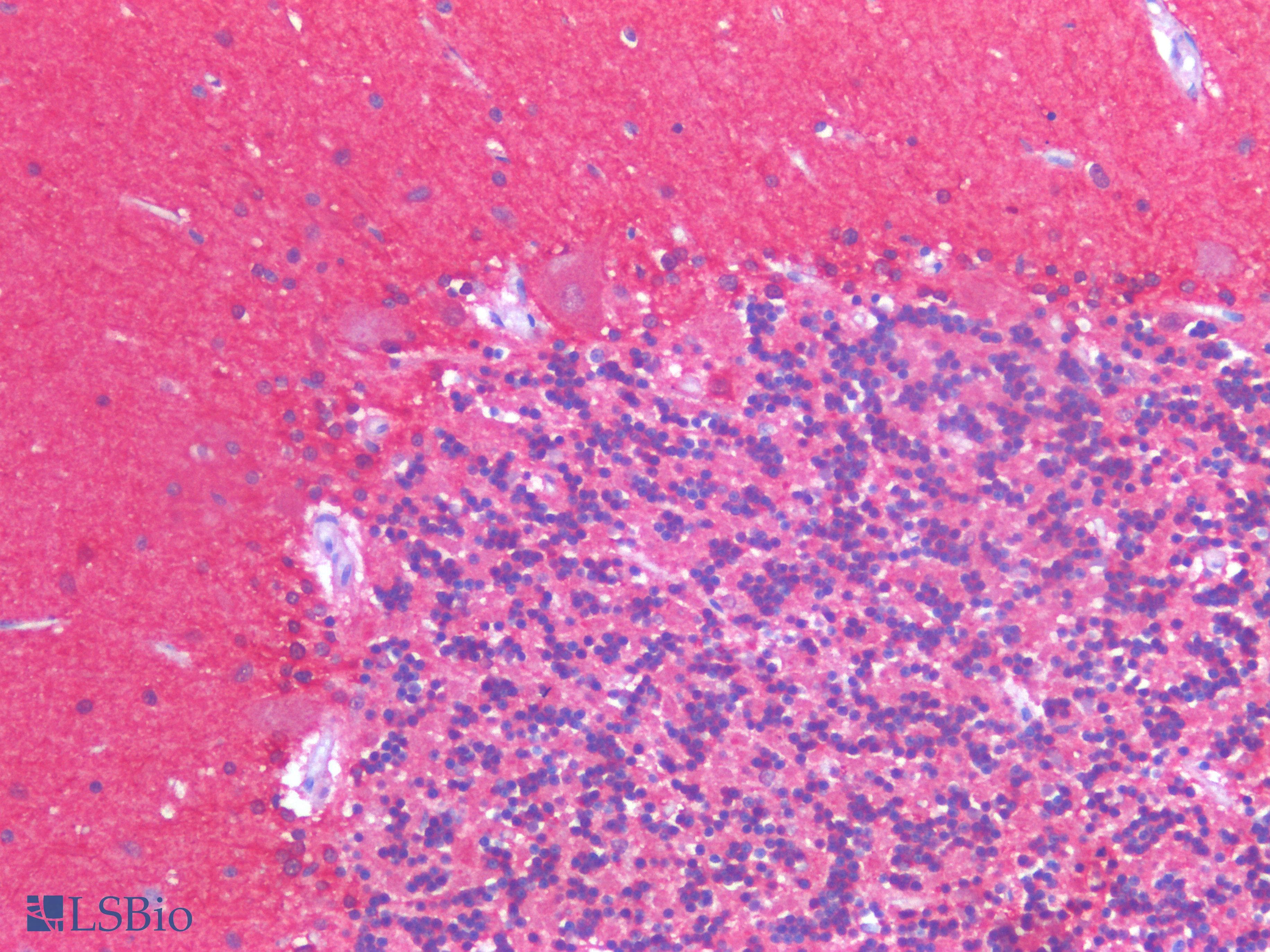 PathPlus™ Polyclonal Rabbit anti-Human CANX / Calnexin Antibody (IHC)