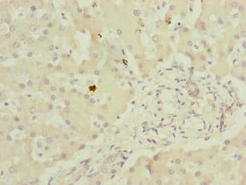 MYO5B / Myosin VB Antibody