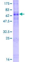 Human ALG3 / NOT Protein (Recombinant GST)