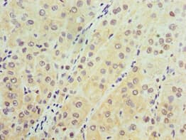 Polyclonal Rabbit anti-Human AARS2 Antibody (aa841-985, IHC)