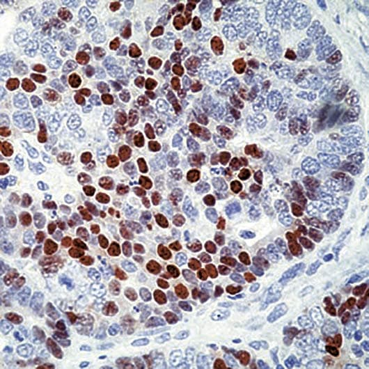 CDKN1C / p57 Kip2 Antibody (clone 57P06)