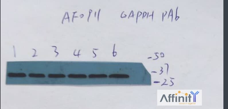 Polyclonal Rabbit anti-Human GAPDH Antibody (WB)