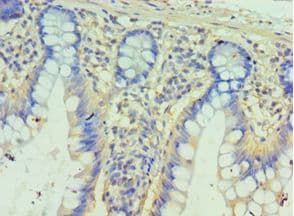 PPID / Cyclophilin D Antibody (aa161-370)