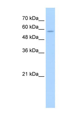 SLC22A16 Antibody (aa101-150)