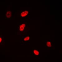 NSUN6 Antibody