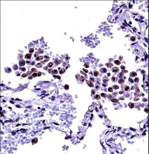 TLR8 Antibody (aa434-463)