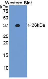 ITGAL / CD11a Antibody (aa809-1066)