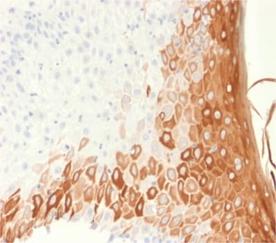KRT10 / CK10 / Cytokeratin 10 Antibody (clone rKRT10/1275, Azide-free, Carrier-free)