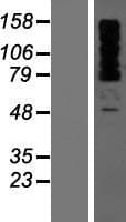OTUD4 Protein (Over-Expression Lysate Myc-DDK (Flag))