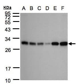 IHC-plus™ AK4 / Adenylate Kinase 4 Antibody (aa1-209)