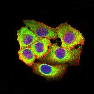 CLEC7A / Dectin 1 Antibody (clone 4G2G6)