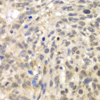TLK2 Antibody
