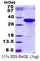 Human F3 / CD142 / Tissue factor Protein (Recombinant His)