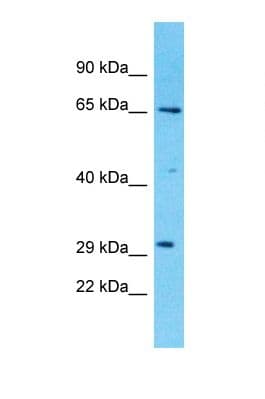 Polyclonal Rabbit anti-Human ZDHHC20 Antibody (N-Terminus, WB)