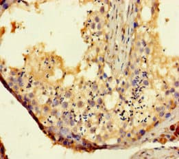 TAS2R14 / TRB1 Antibody