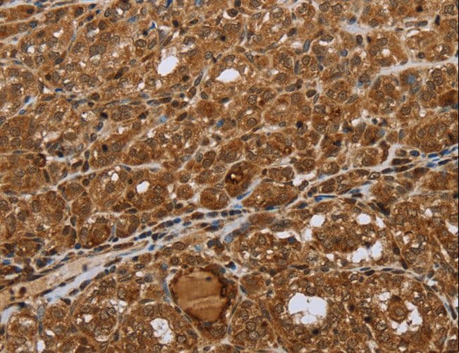 STMN2 + STMN3 + STMN4 Antibody
