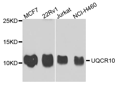 UQCR10 / UCRC Antibody