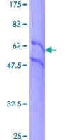 Human EGFR Protein (Recombinant GST)