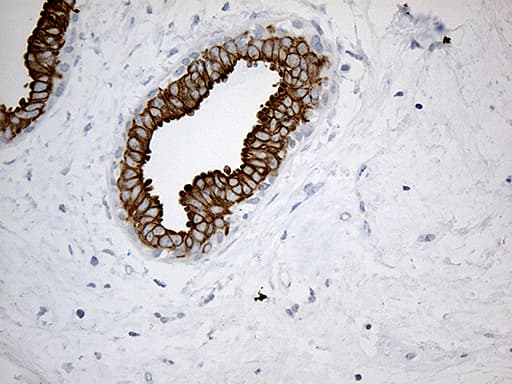 SYNE1 / Nesprin 1 Antibody (aa1-285, clone OTI1E10)