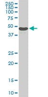 IHC-plus™ Monoclonal Mouse anti-Human STK38 Antibody (clone 6F1, IHC, WB)