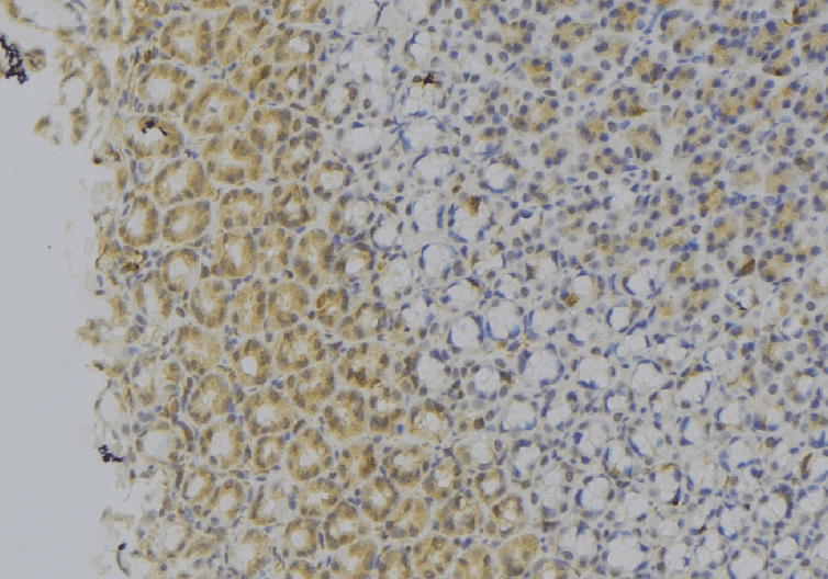 Polyclonal Rabbit anti-Human MCAD / ACADM Antibody (IHC, WB)