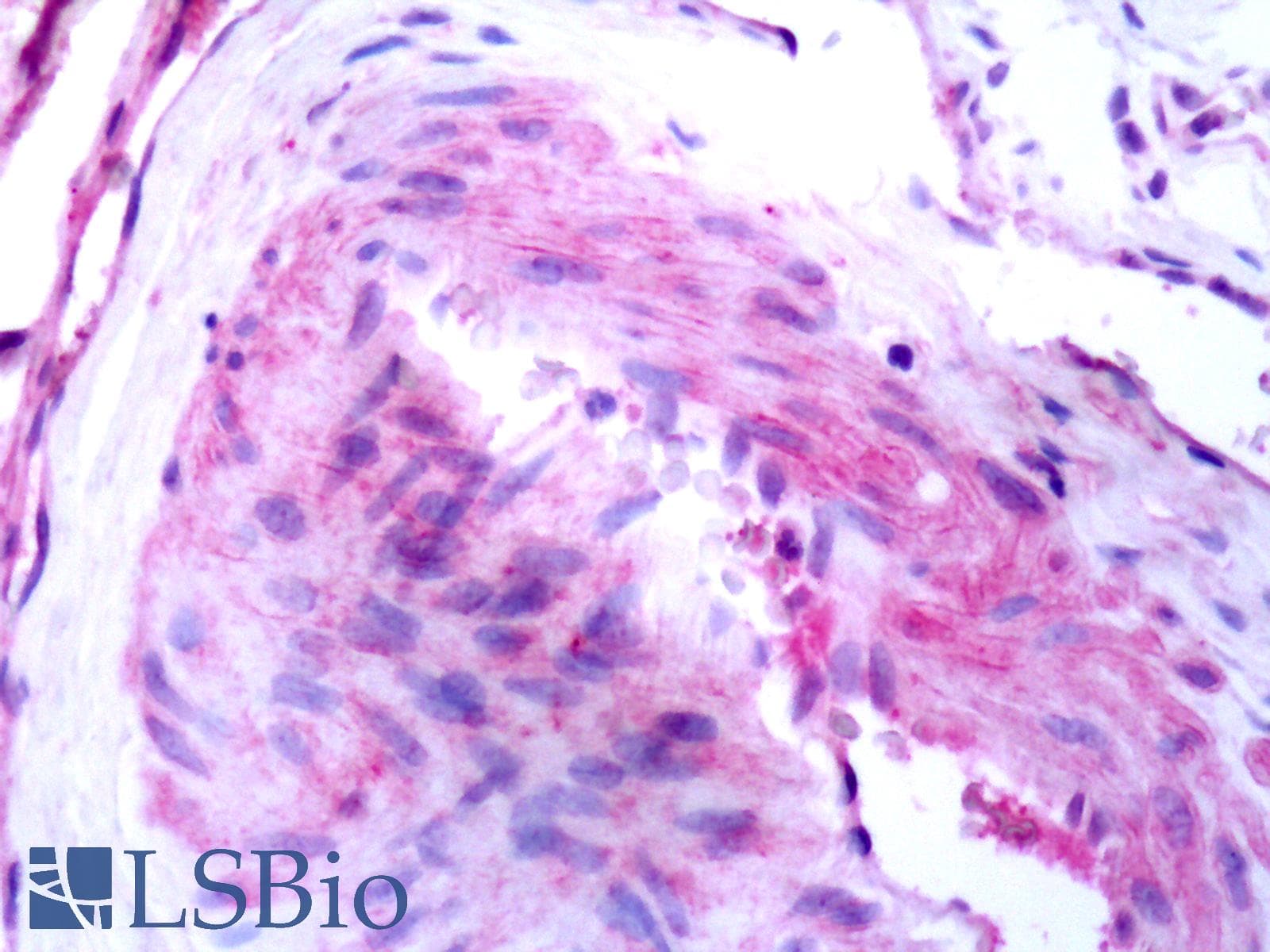 PathPlus™ Polyclonal Rabbit anti-Human B1R / BDKRB1 Antibody (C-Terminus, IHC)
