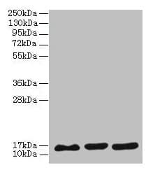 Polyclonal Rabbit anti-Human SYNJ2BP / OMP25 Antibody (IHC, WB)