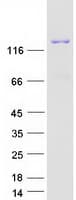 Human AGL Protein (Recombinant Myc-DDK (Flag))