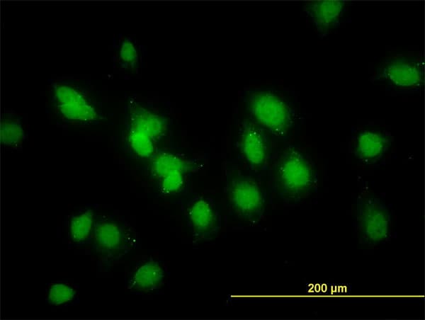 SMAD1 Antibody (clone 2E9)