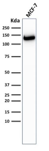 IHC-plus™ Recombinant Monoclonal Rabbit anti-Human CDH1 / E Cadherin Antibody (clone CDH1/2208R, IHC, IF, WB)