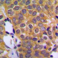 DUSP1 / MKP1 Antibody (C-Terminus)