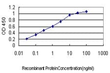 IHC-plus™ Monoclonal Mouse anti-Human B2M / Beta 2 Microglobulin Antibody (clone 3F9-2C2, IHC, IF, WB)
