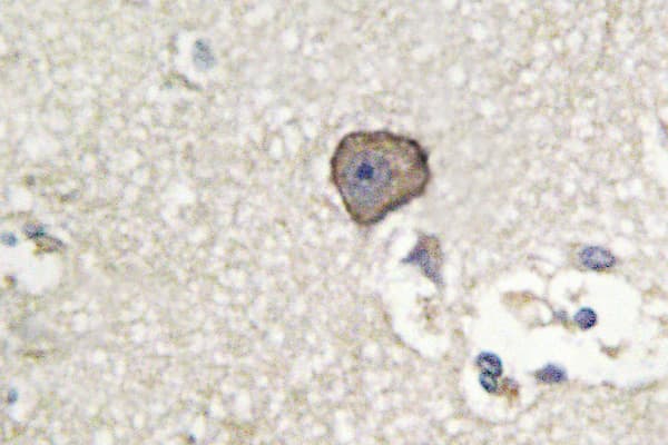 CDH15 / M Cadherin Antibody (Ala108)