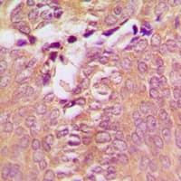 DAPK1 / DAP Kinase Antibody (Internal)