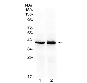 OTC Antibody