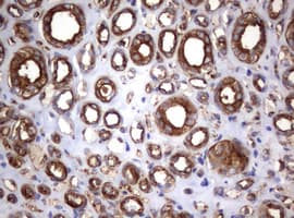 CD30 Antibody (clone OTI16H5)