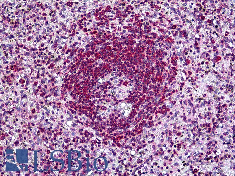 IHC-plus™ Polyclonal Goat anti-Human SH3KBP1 / CIN85 Antibody (aa2-14, IHC)