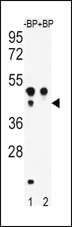 ATF4 Antibody (Ser245)