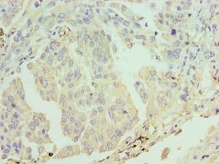 ERCC2 / XPD Antibody (aa1-300)