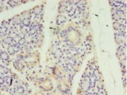 STRADB / ALS2CR2 Antibody