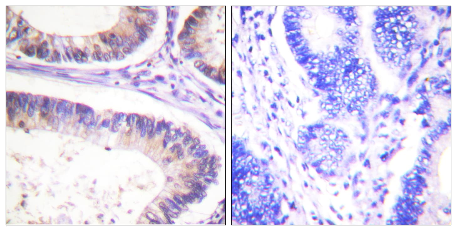 Polyclonal Rabbit anti-Human c-CBL Antibody (phospho-Tyr674, IHC, WB)