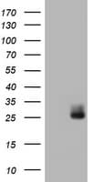 WFDC2 / HE4 Antibody (clone OTI1B9)