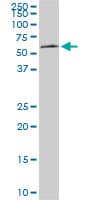 IHC-plus™ AAAS / Adracalin Antibody (clone 5A1)