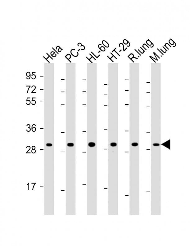 Polyclonal Rabbit anti-Human RPS4X Antibody (C-Terminus, WB)