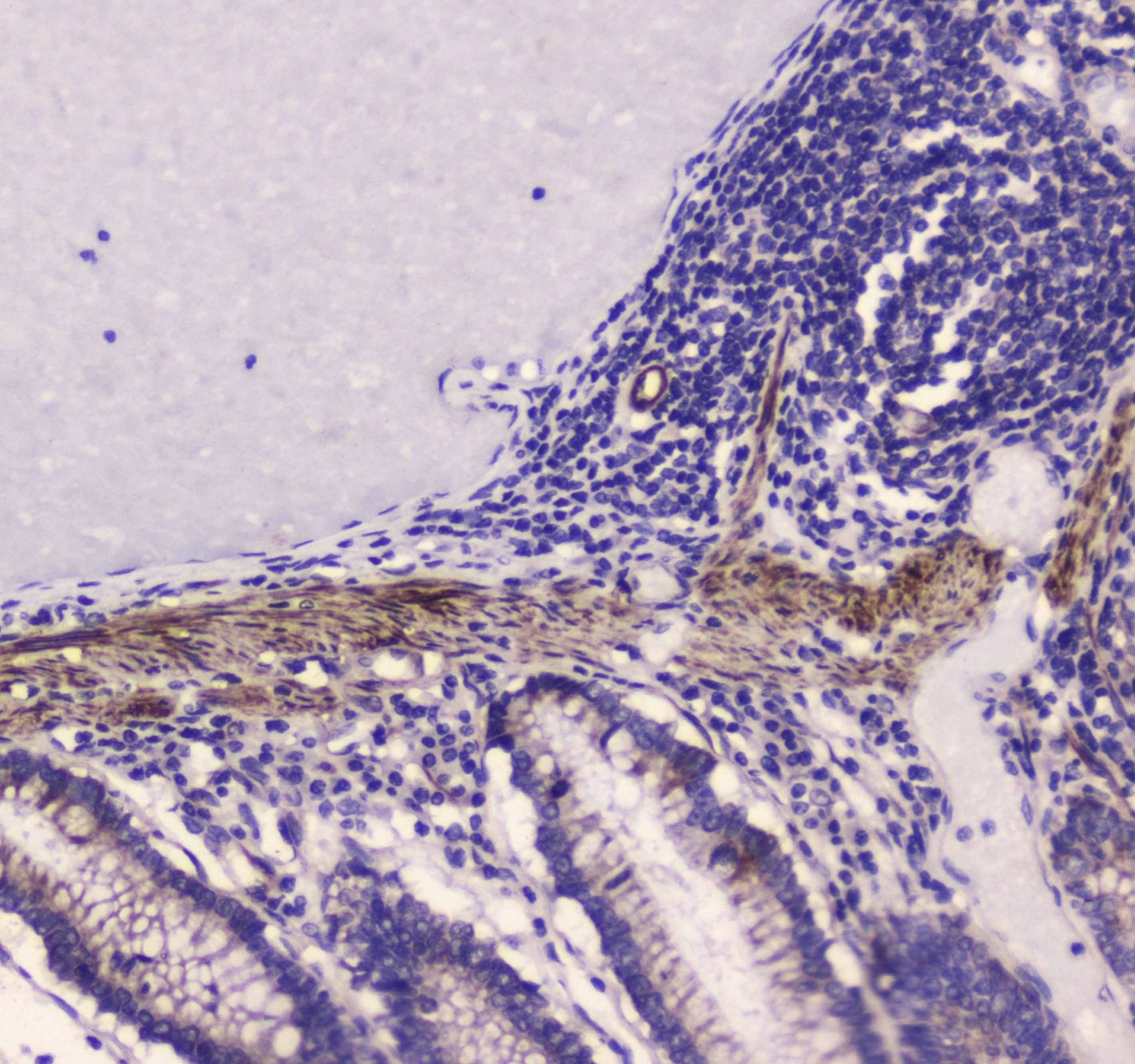 MYLK Antibody