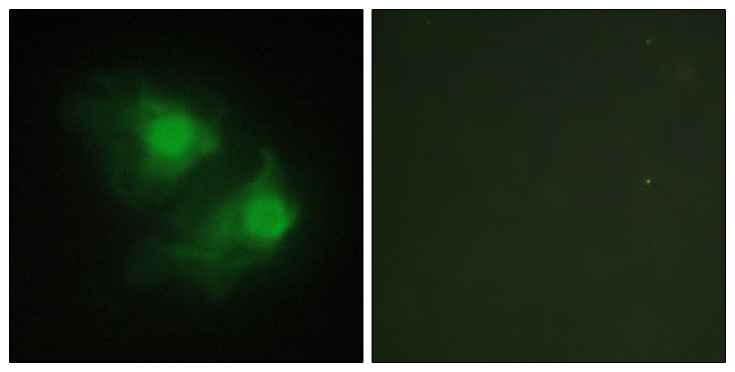 Polyclonal Rabbit anti-Human LIMK2 Antibody (aa461-510, IHC, IF, WB)