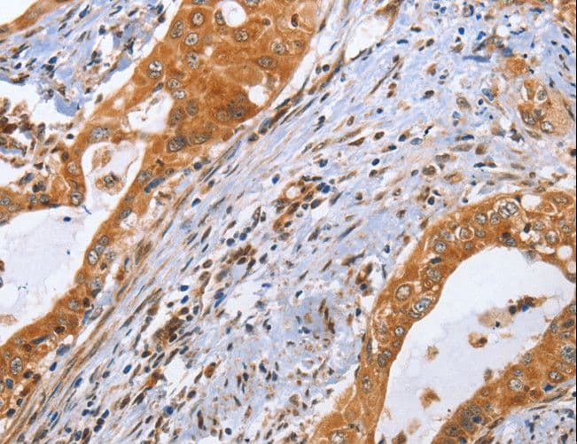 CDK19 / CDK11 Antibody