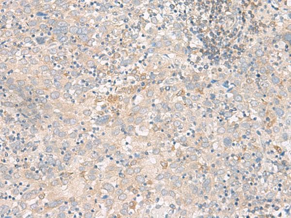 FGF13 Antibody