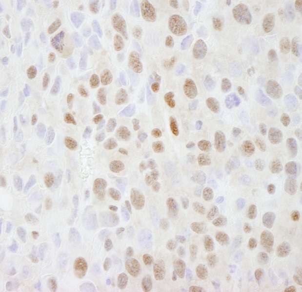 Polyclonal Rabbit anti-Human SMARCC2 Antibody (aa1164-C-term, IHC)