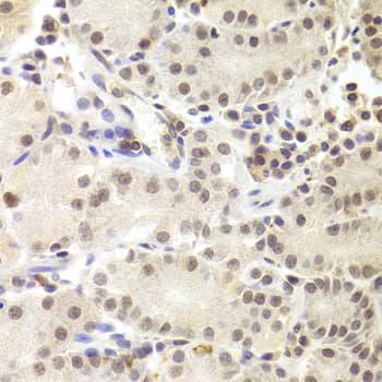 PRPF3 Antibody